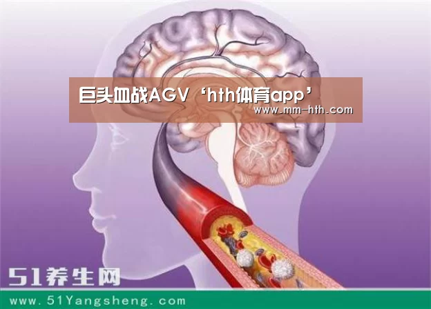 巨头血战AGV‘hth体育app’